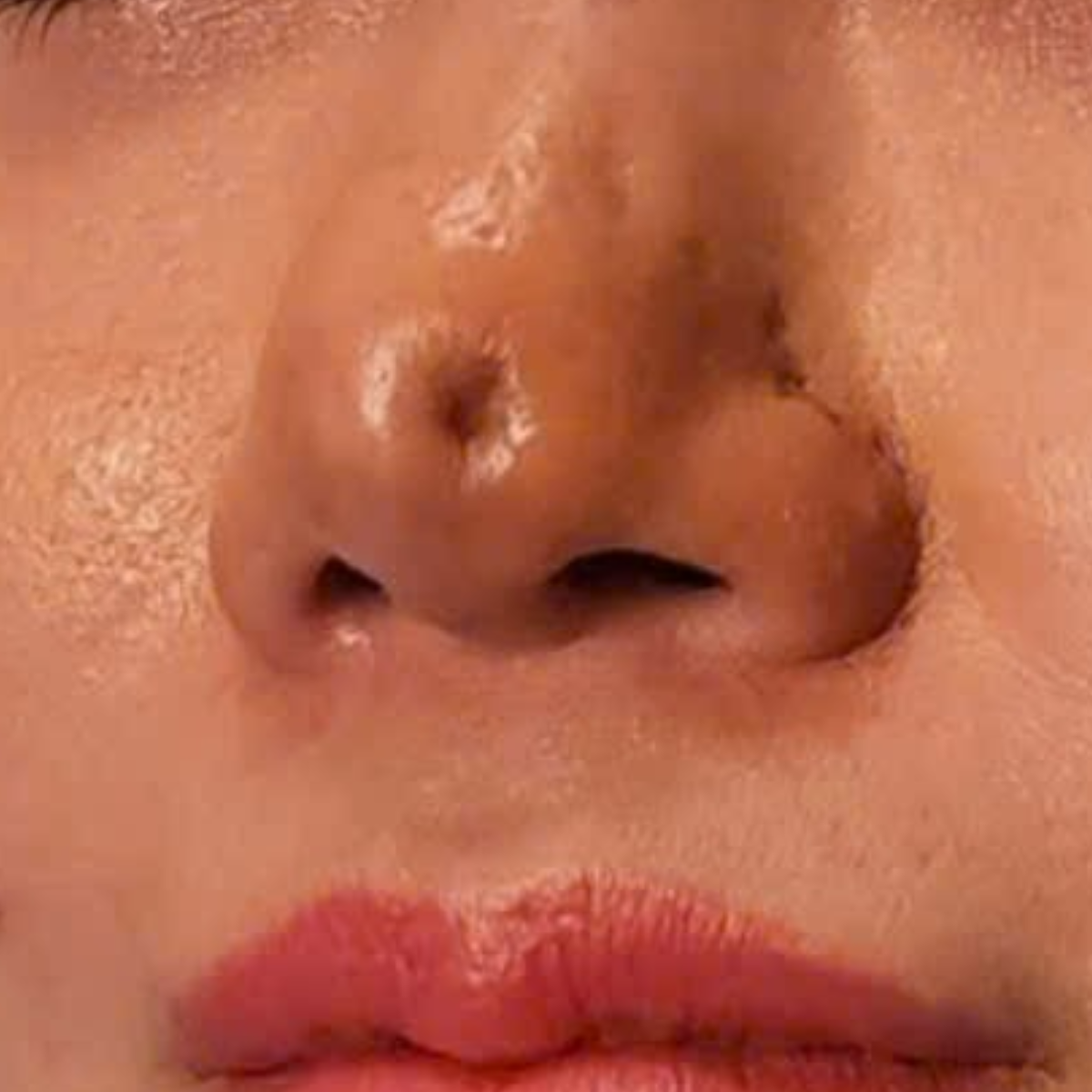 Hình ảnh trước chăm sóc ca lâm sàng 05
